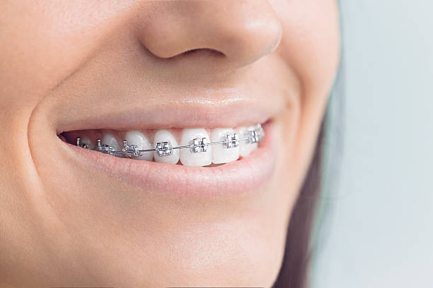 Best Wisdom Tooth Removal  in Clemmons, NC